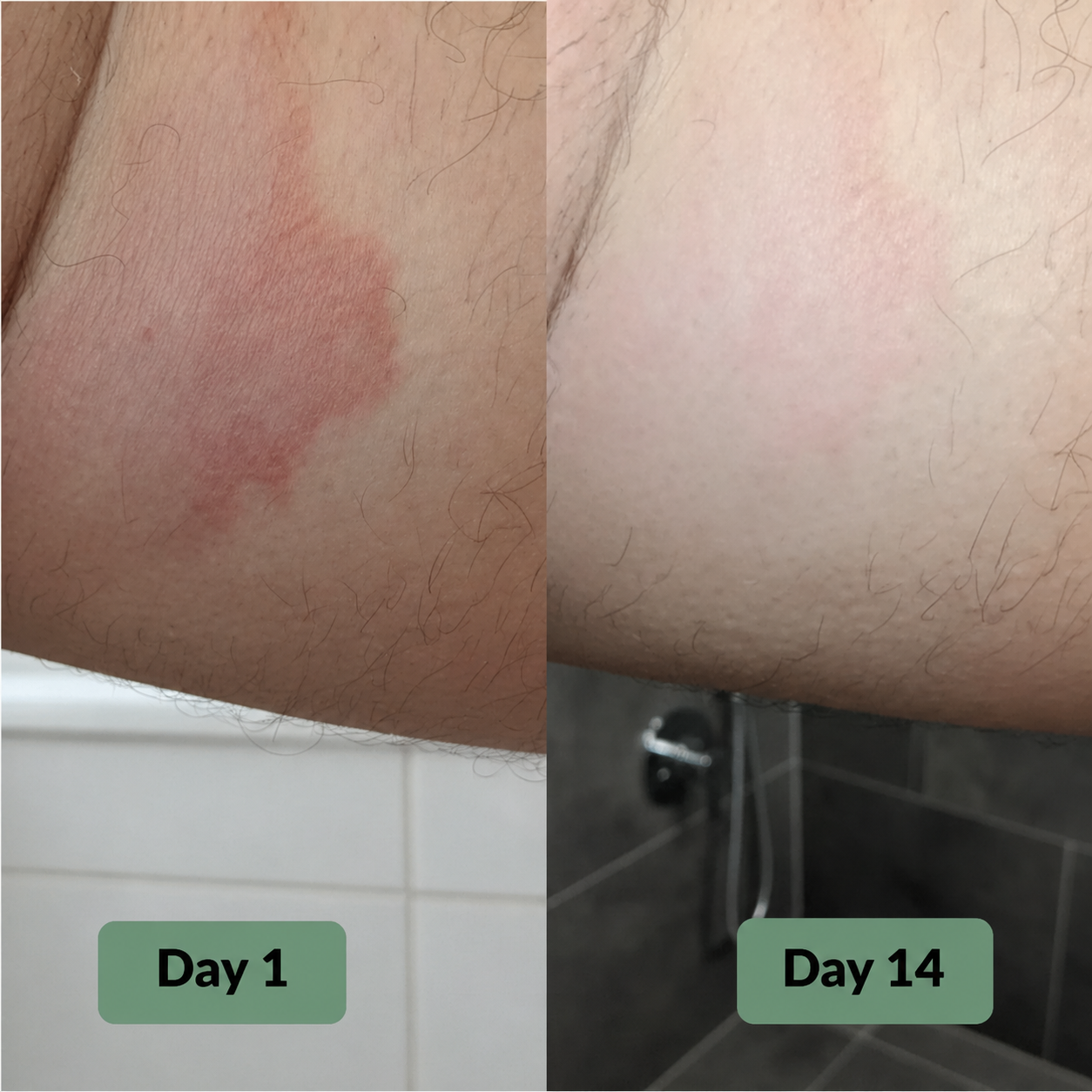 Vuneva Relief Soap