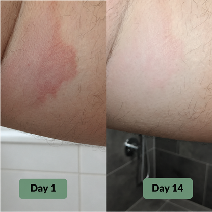 Vuneva Relief Soap